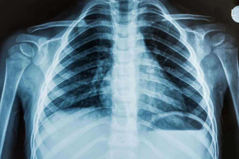 radiologia